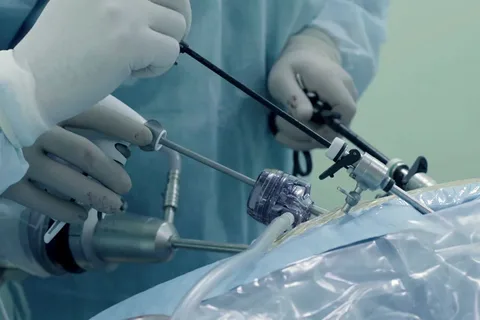 Sympathectomy