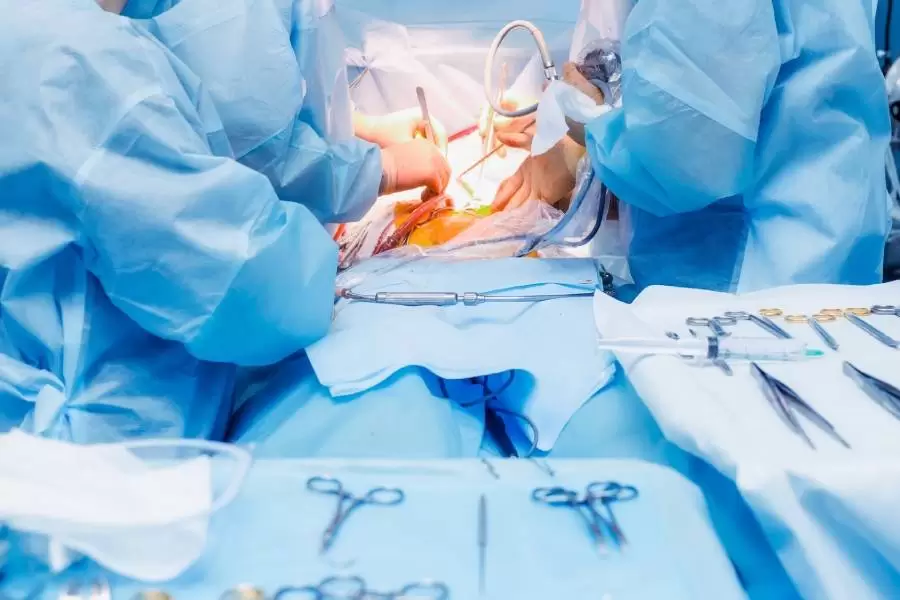 Splenectomy