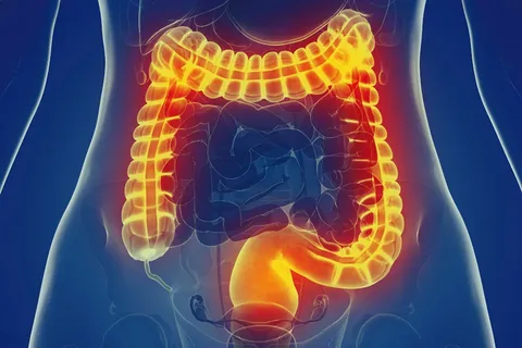 Left Hemicolectomy