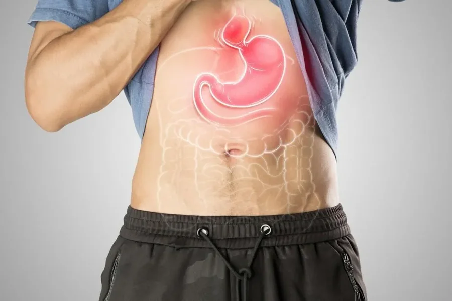Hiatal hernia